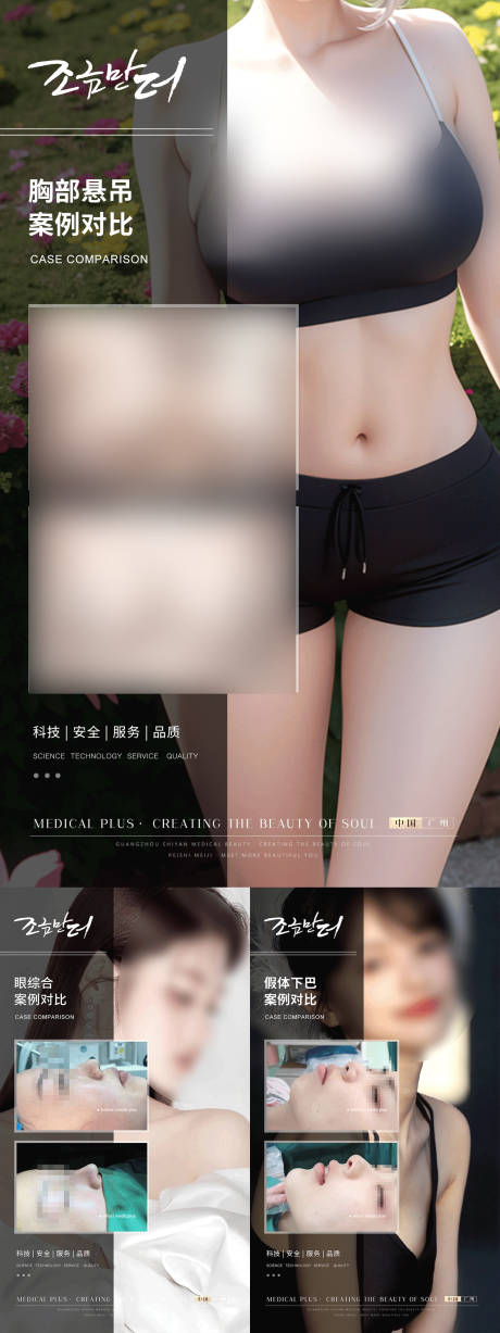 源文件下载【医美案例】编号：55380017464053916