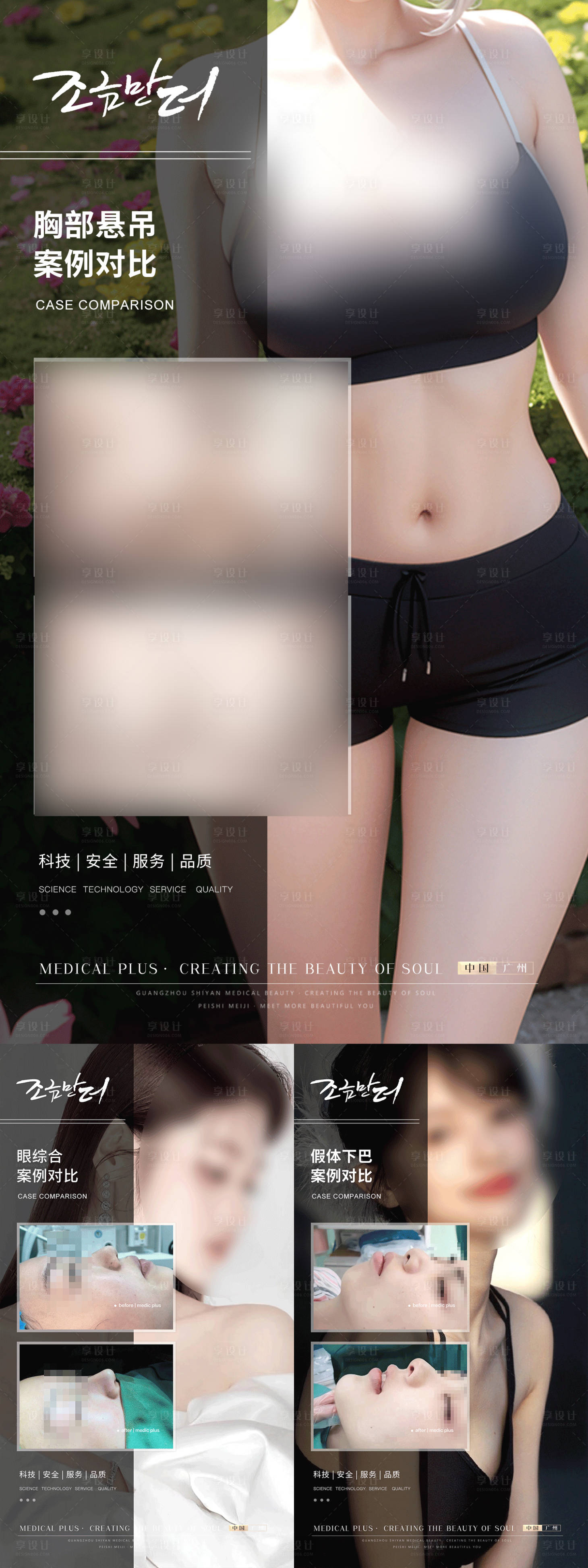 源文件下载【医美案例】编号：55380017464053916