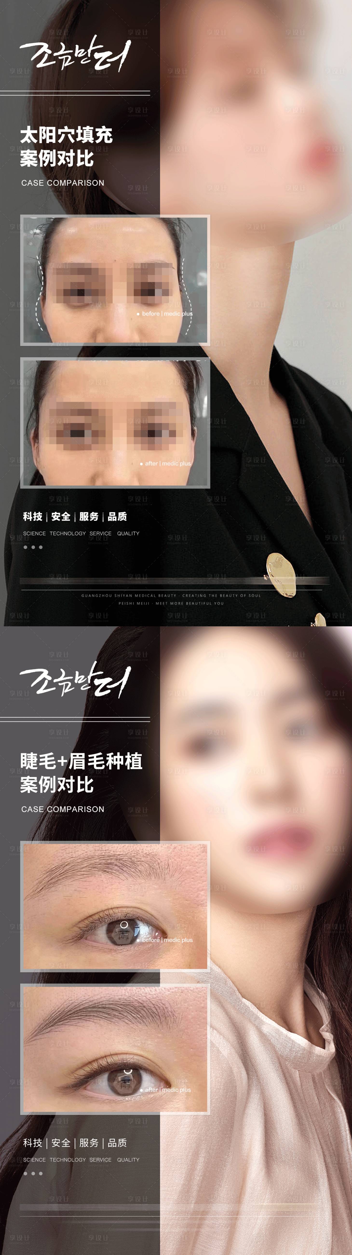 源文件下载【享设计】搜索编号：21170017371324641【整形案例】