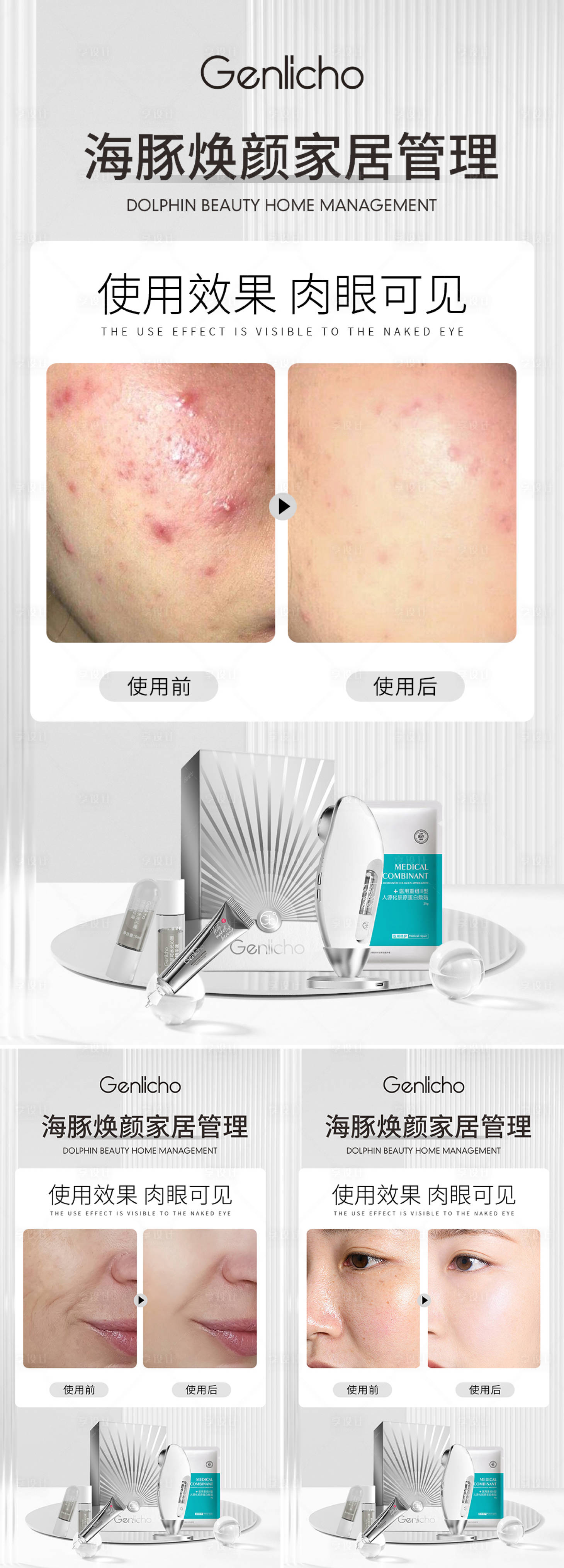 源文件下载【享设计】搜索编号：83330017323325838【医美仪器案例对比海报】