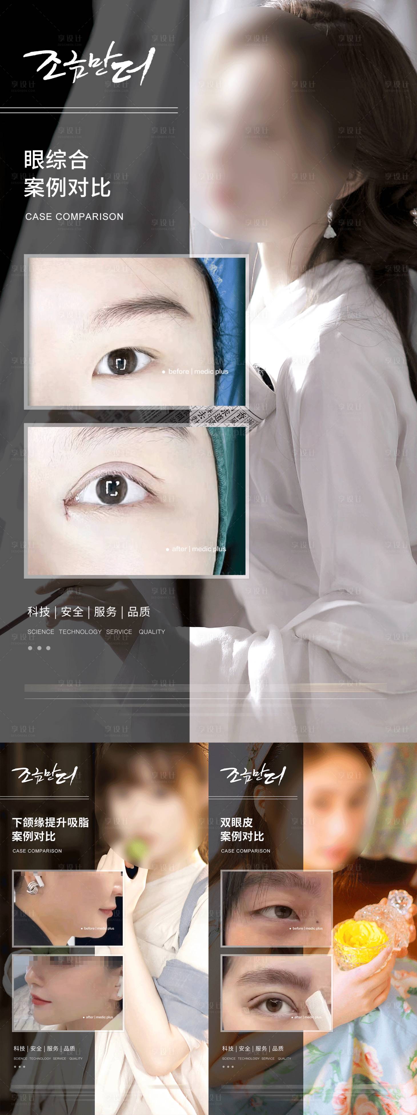 源文件下载【医美案例对比系列海报】编号：58200017352342919