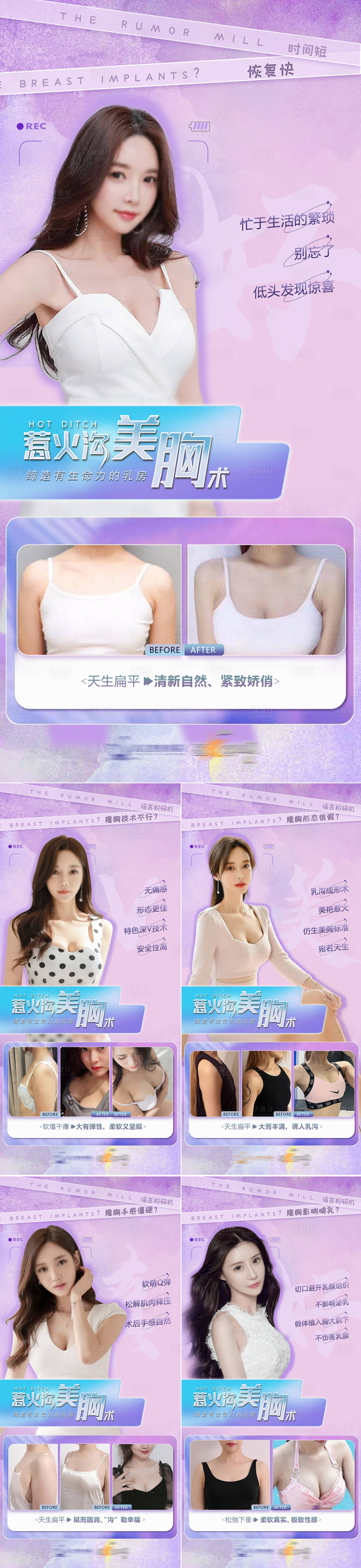 源文件下载【享设计】搜索编号：91350017134363386【医美美胸术案例海报】