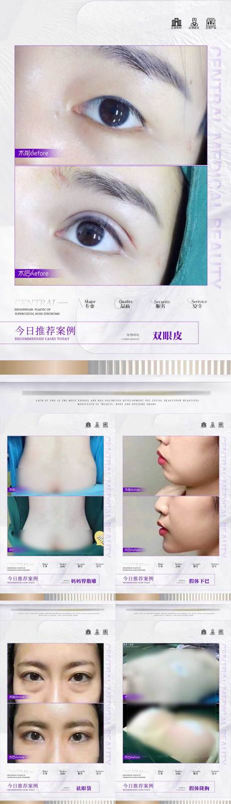 源文件下载【享设计】搜索编号：72520017731195686【医美案例合集案例分享】
