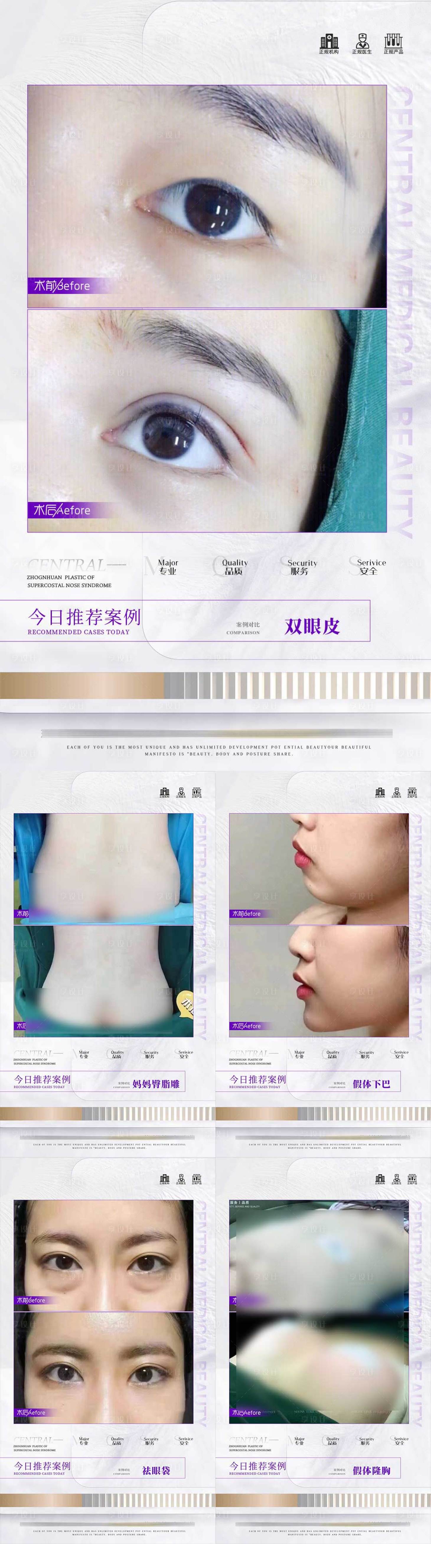 源文件下载【享设计】搜索编号：72520017731195686【医美案例合集案例分享】