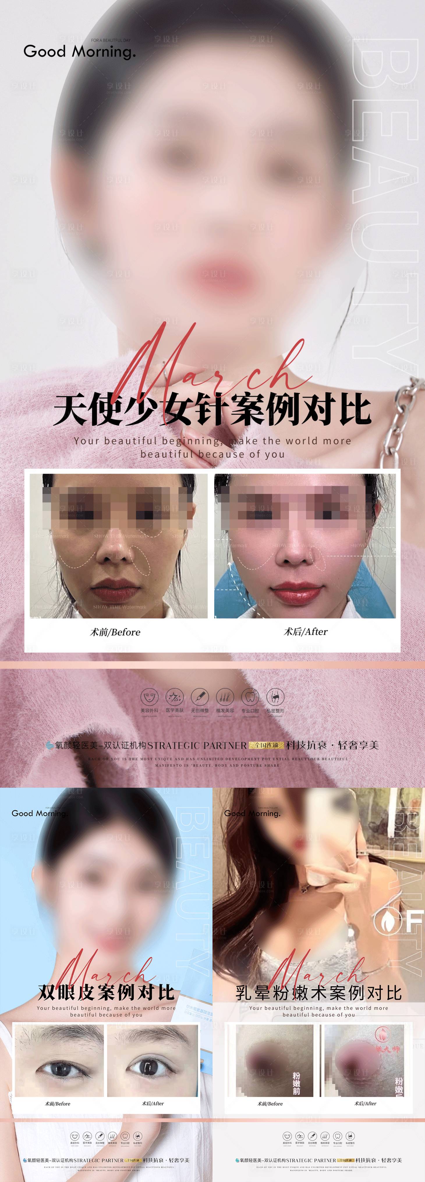 源文件下载【整形真人案例分享集】编号：18230017371343796