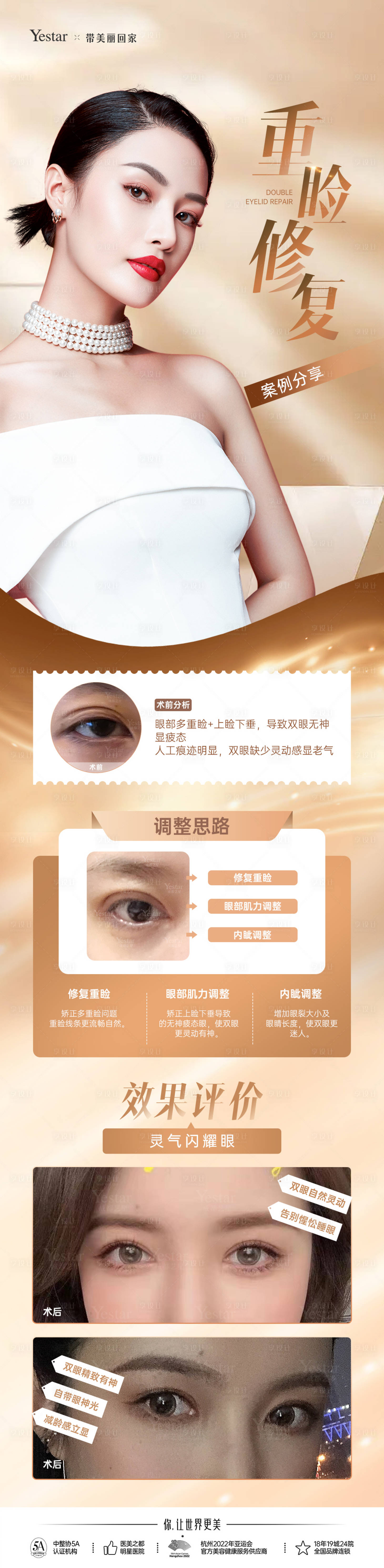 源文件下載【享設計】搜索編號：35050017670786413【外科眼修復長圖】