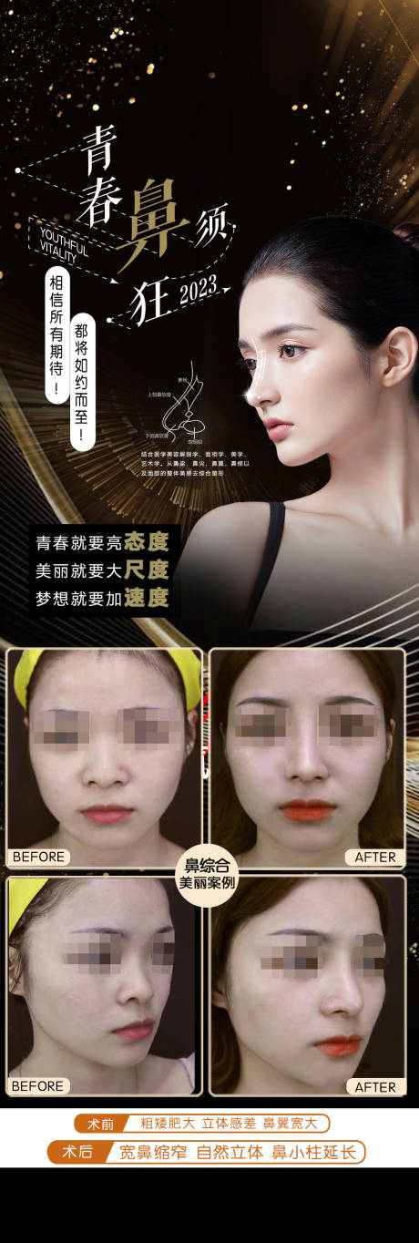 鼻综合案例海报-源文件【享设计】