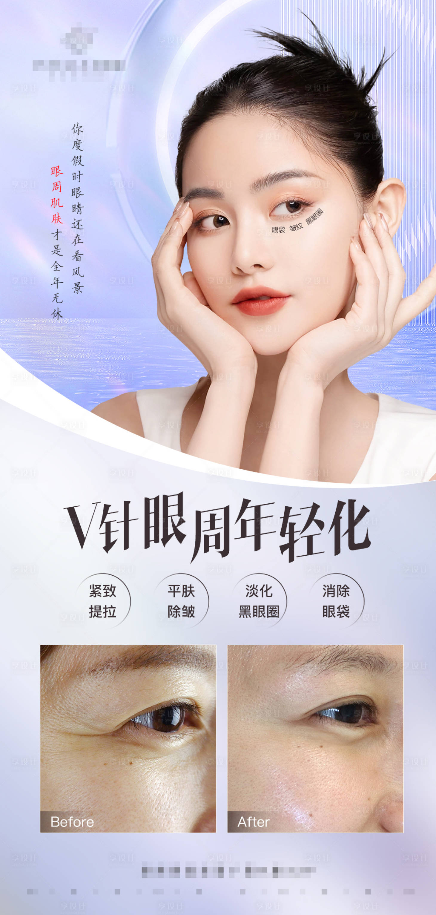 源文件下载【眼周年轻化案例宣传海报】编号：21720017298189525