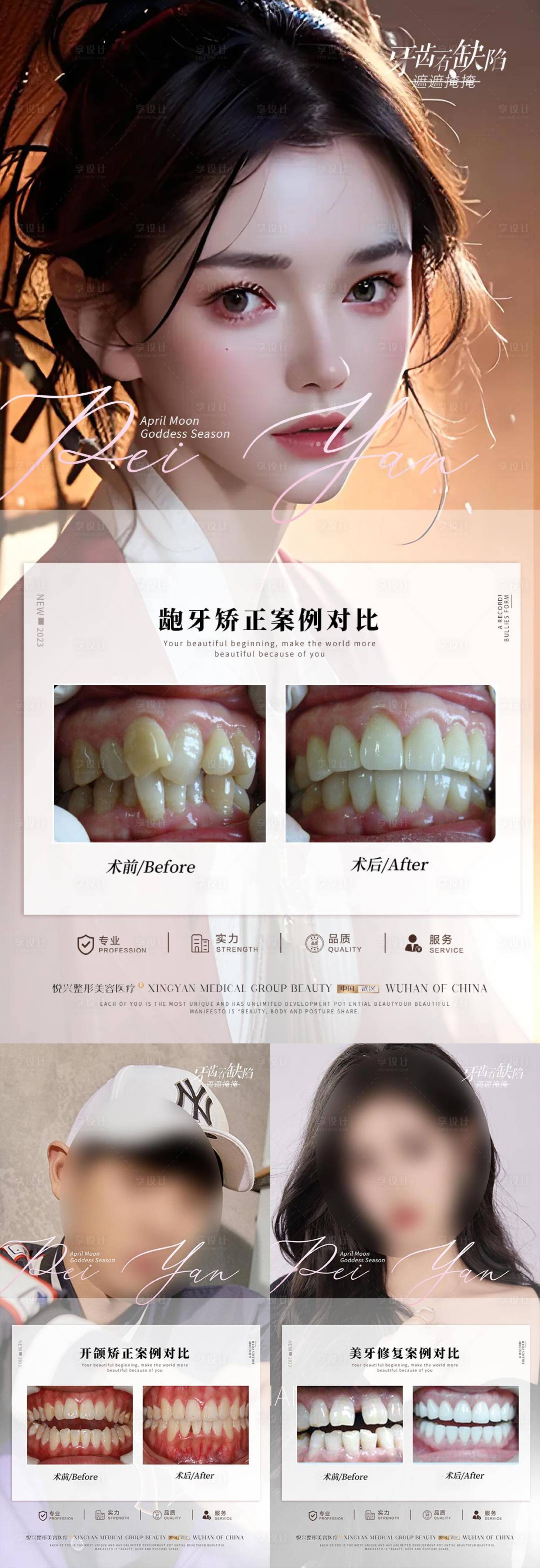 源文件下载【口腔案例对比海报】编号：41860017636453724