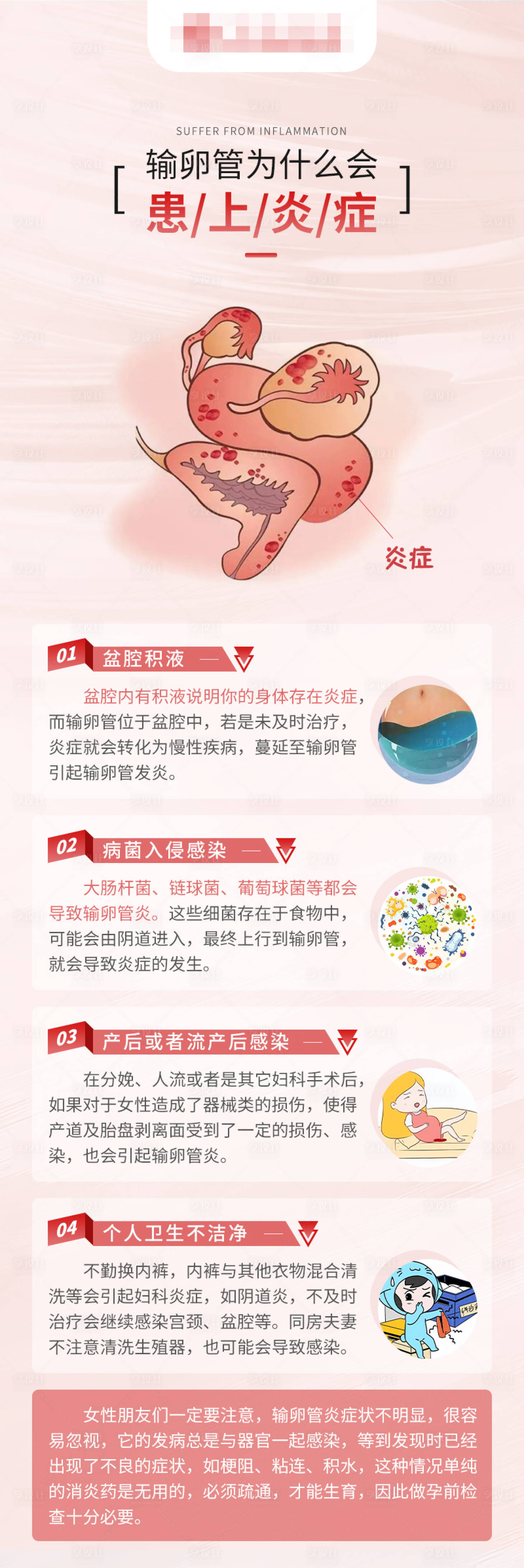 源文件下載【享設(shè)計】搜索編號：27500017105337568【不孕科普輸卵管炎癥】