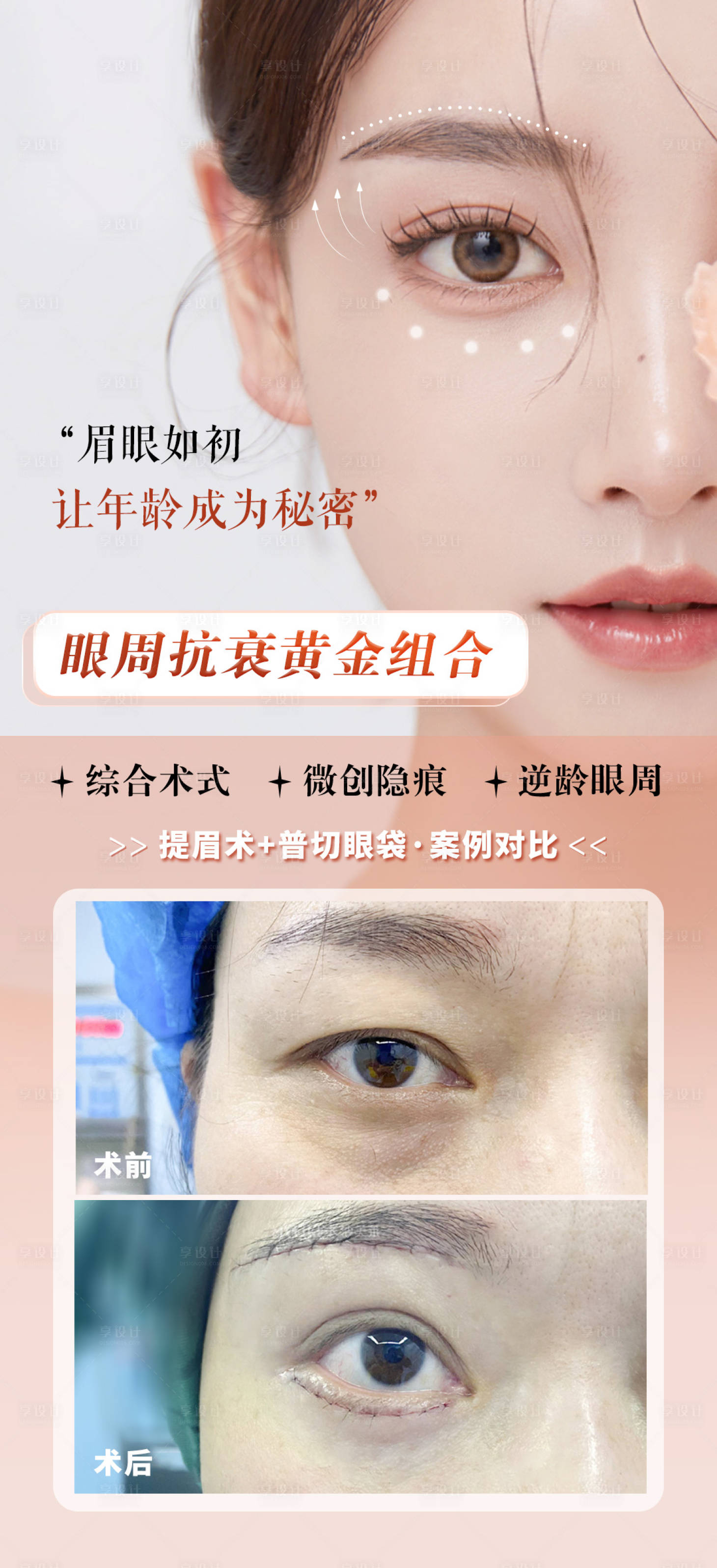 源文件下載【享設計】搜索編號：72520017733711404【眼周年輕整形案例】