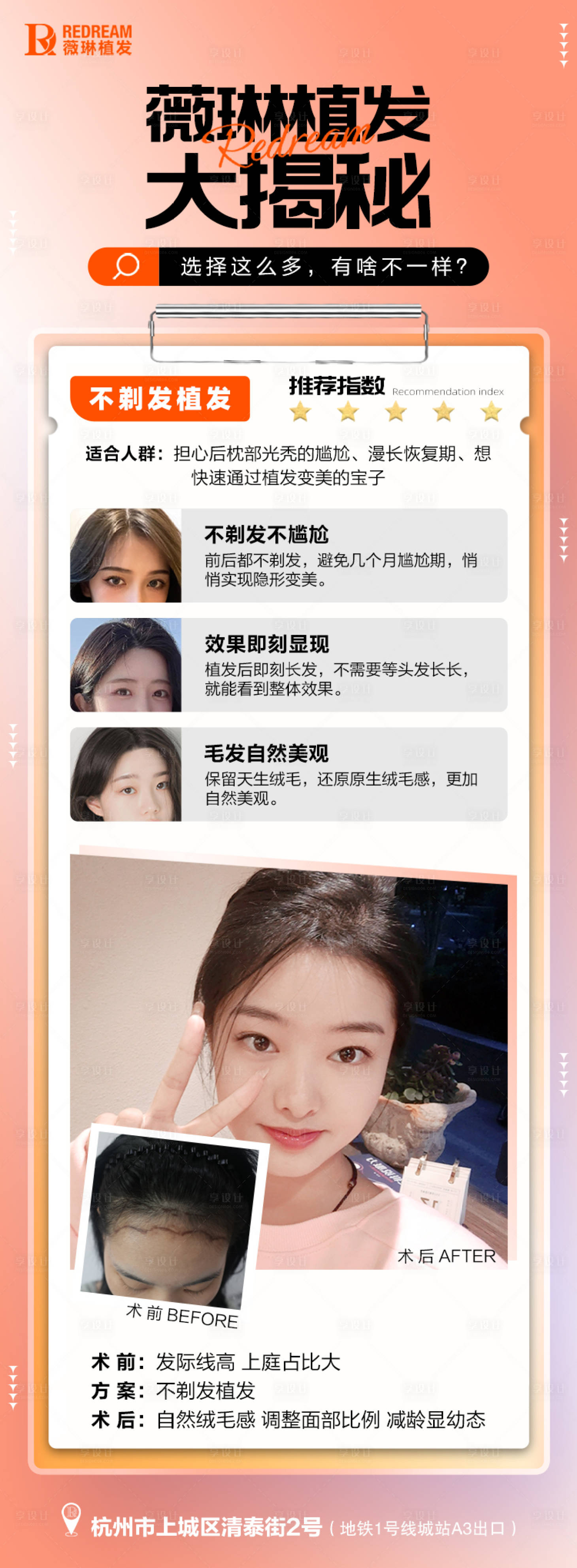 源文件下载【享设计】搜索编号：34220017288746359【医美植发长图】