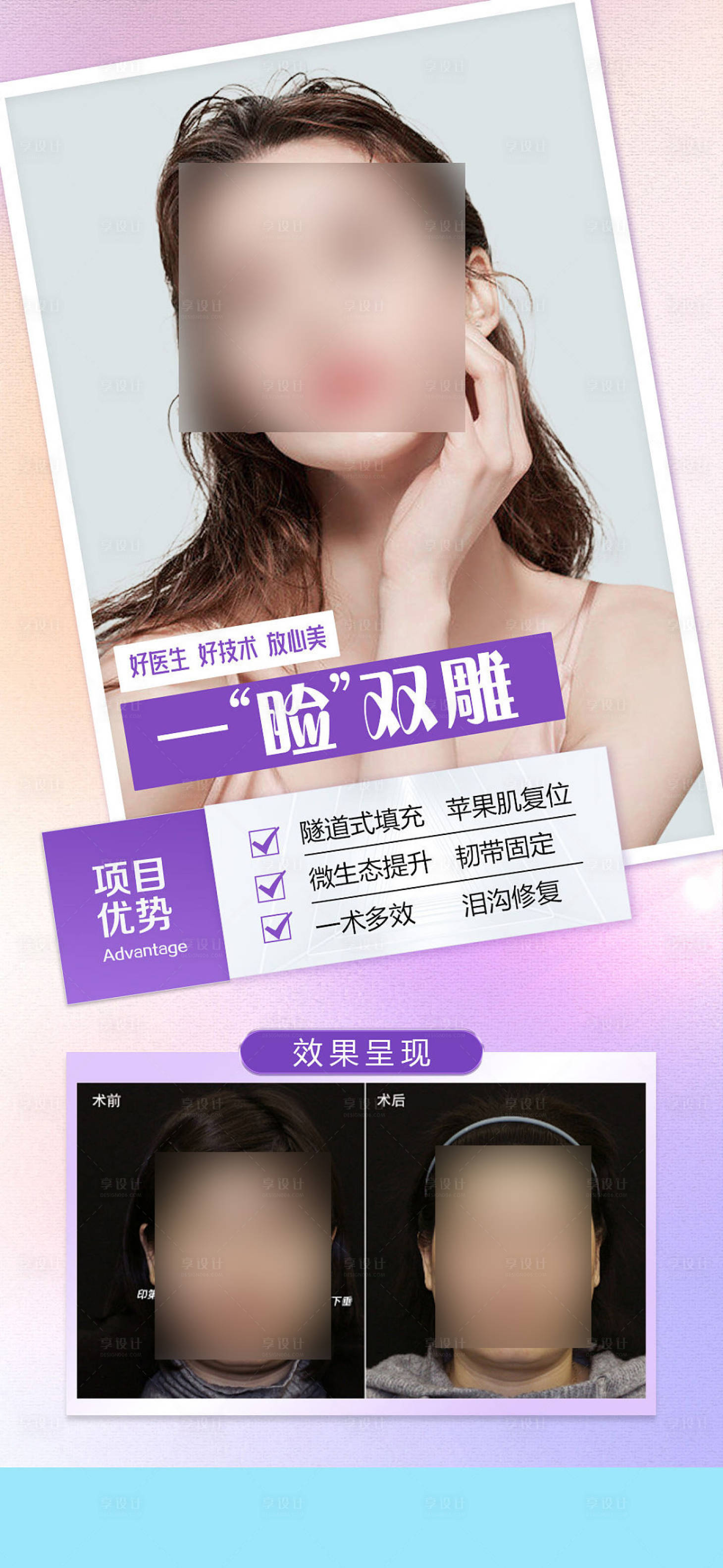 源文件下載【享設計】搜索編號：41970017308728334【眼瞼案例海報】