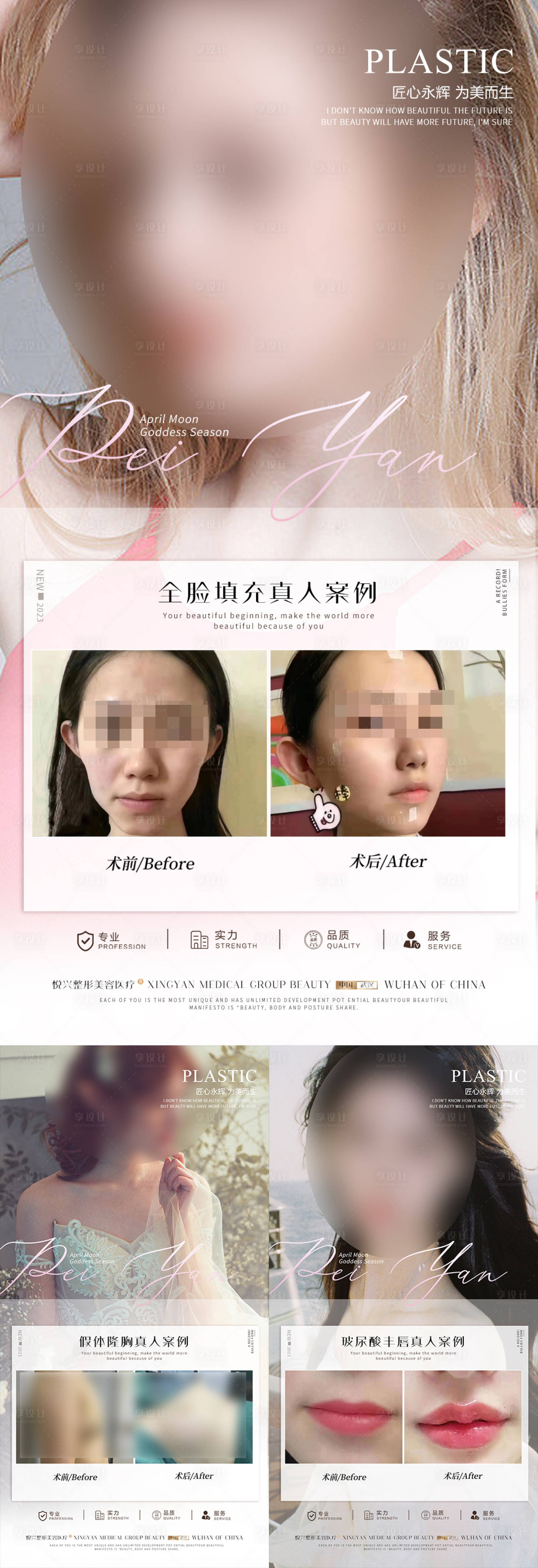 源文件下载【享设计】搜索编号：39040017281617676【整形案例宣传海报】