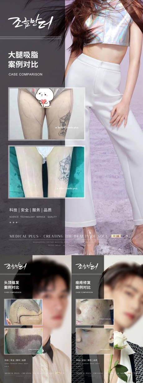 源文件下载【医美植发案例对比】编号：82150017559273369