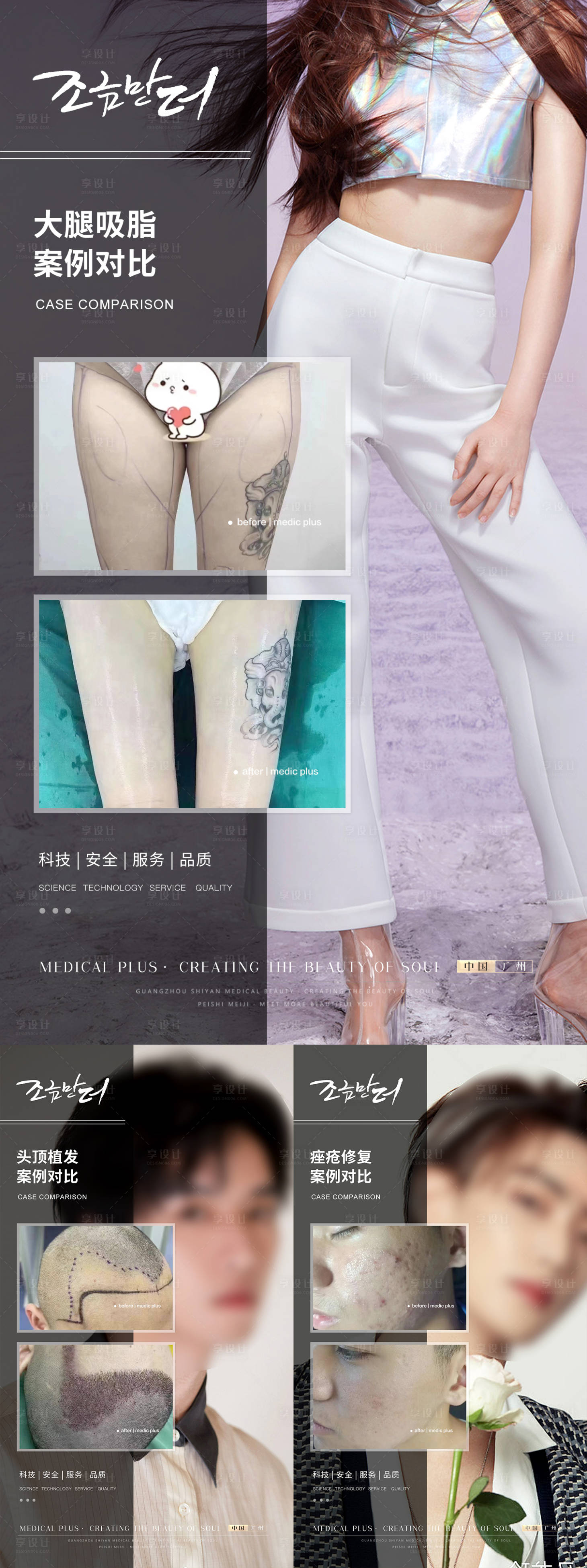 源文件下载【医美植发案例对比】编号：82150017559273369