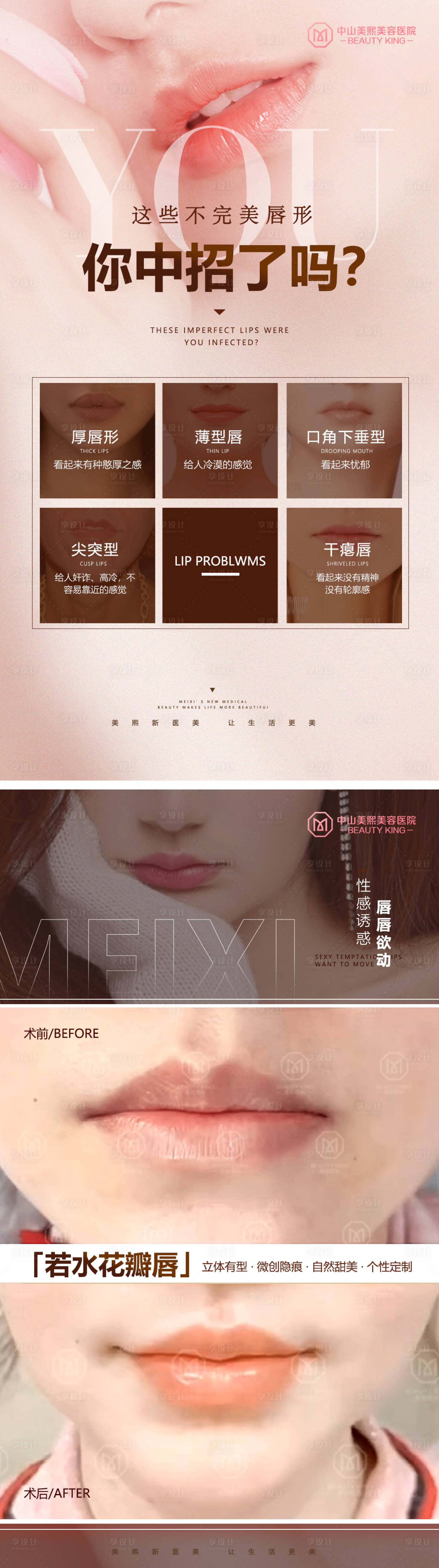 源文件下载【不完美唇形变美案例海报】编号：44430017651328656