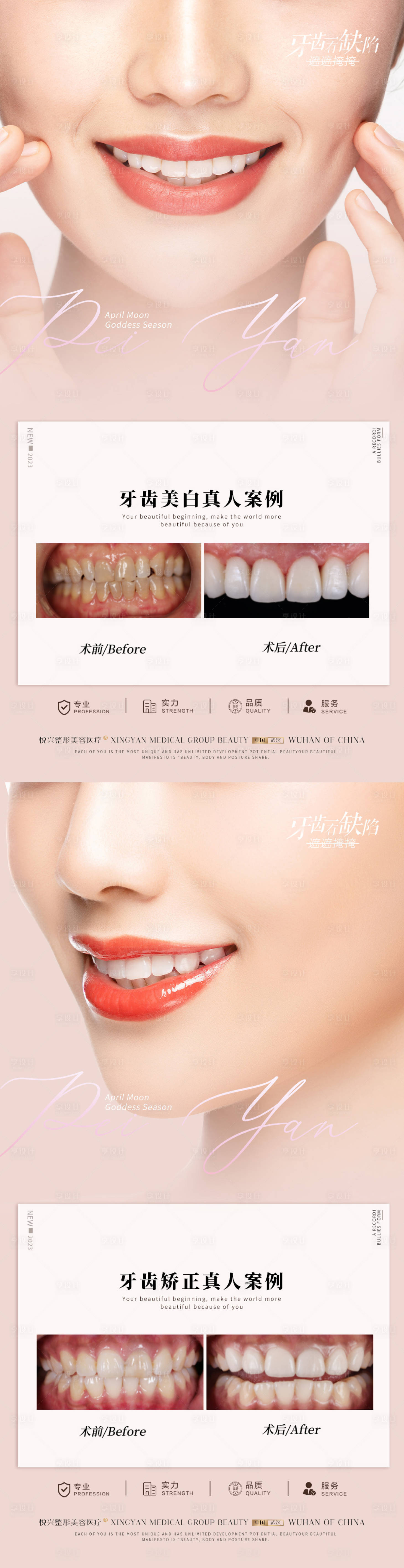 源文件下載【享設計】搜索編號：75120017526932229【口腔案例對比海報】