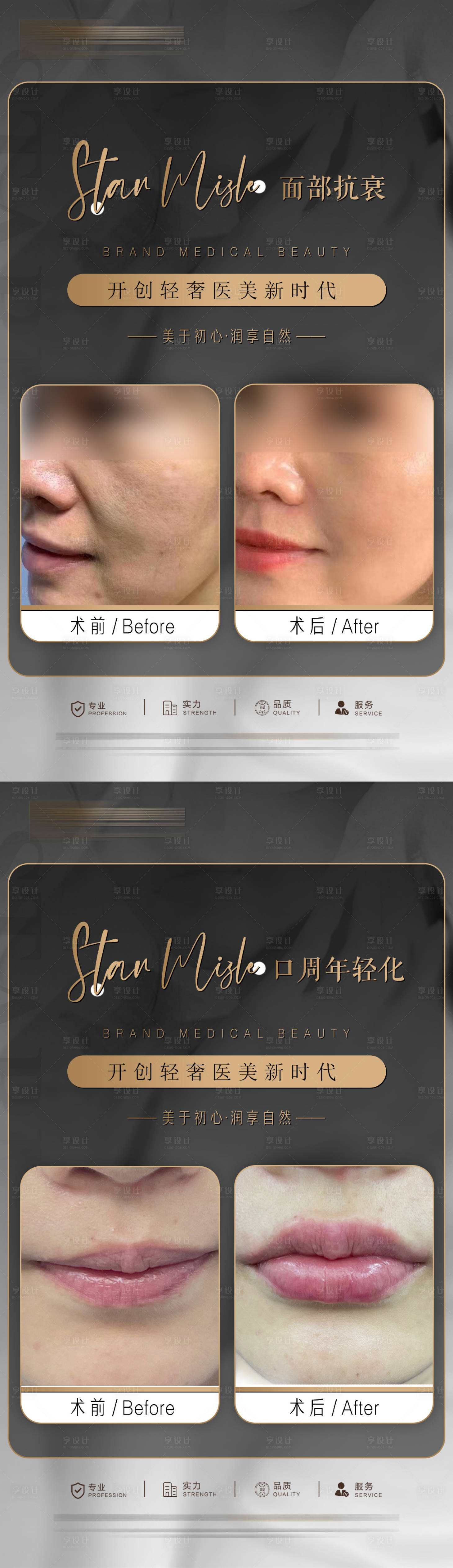 源文件下載【享設(shè)計(jì)】搜索編號(hào)：22000017264452052【整形真人案例分享海報(bào)】