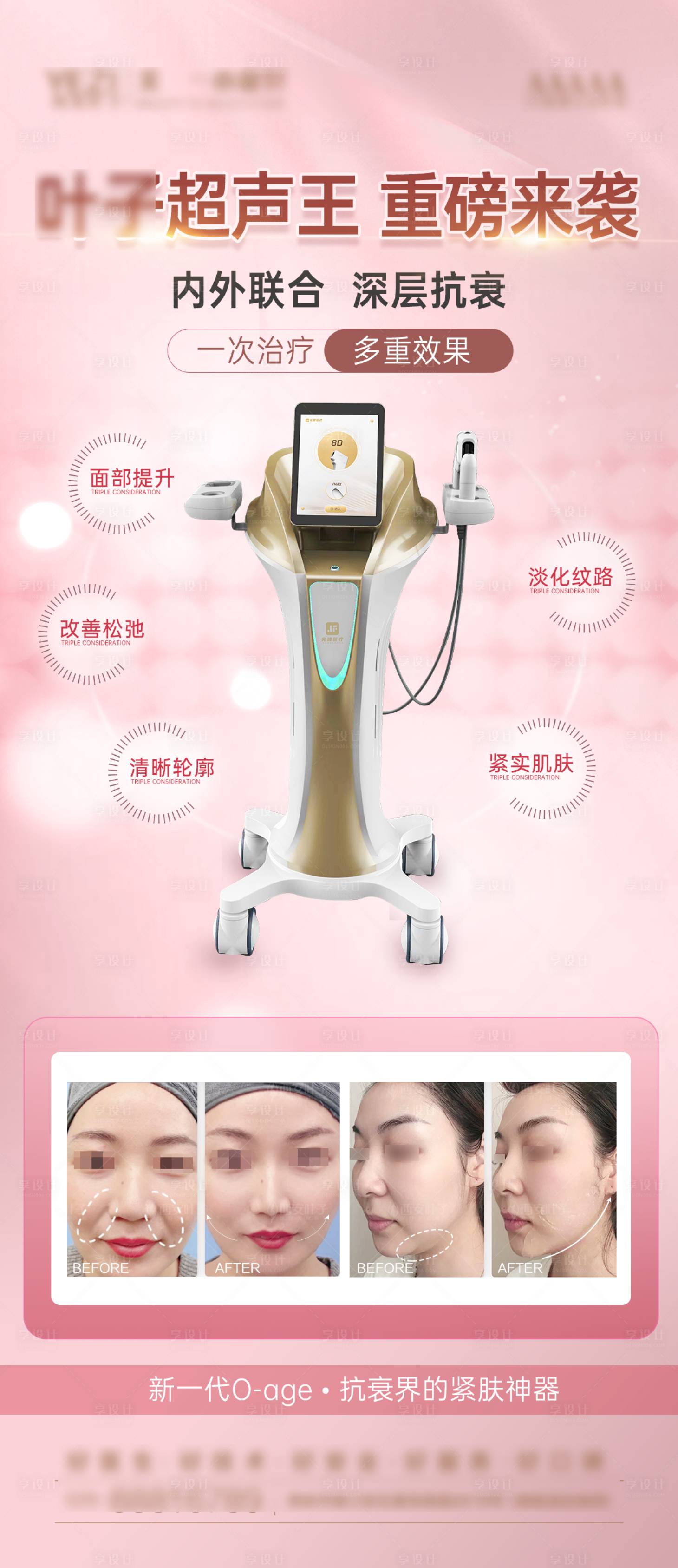 源文件下载【医美仪器海报】编号：45810017299232273