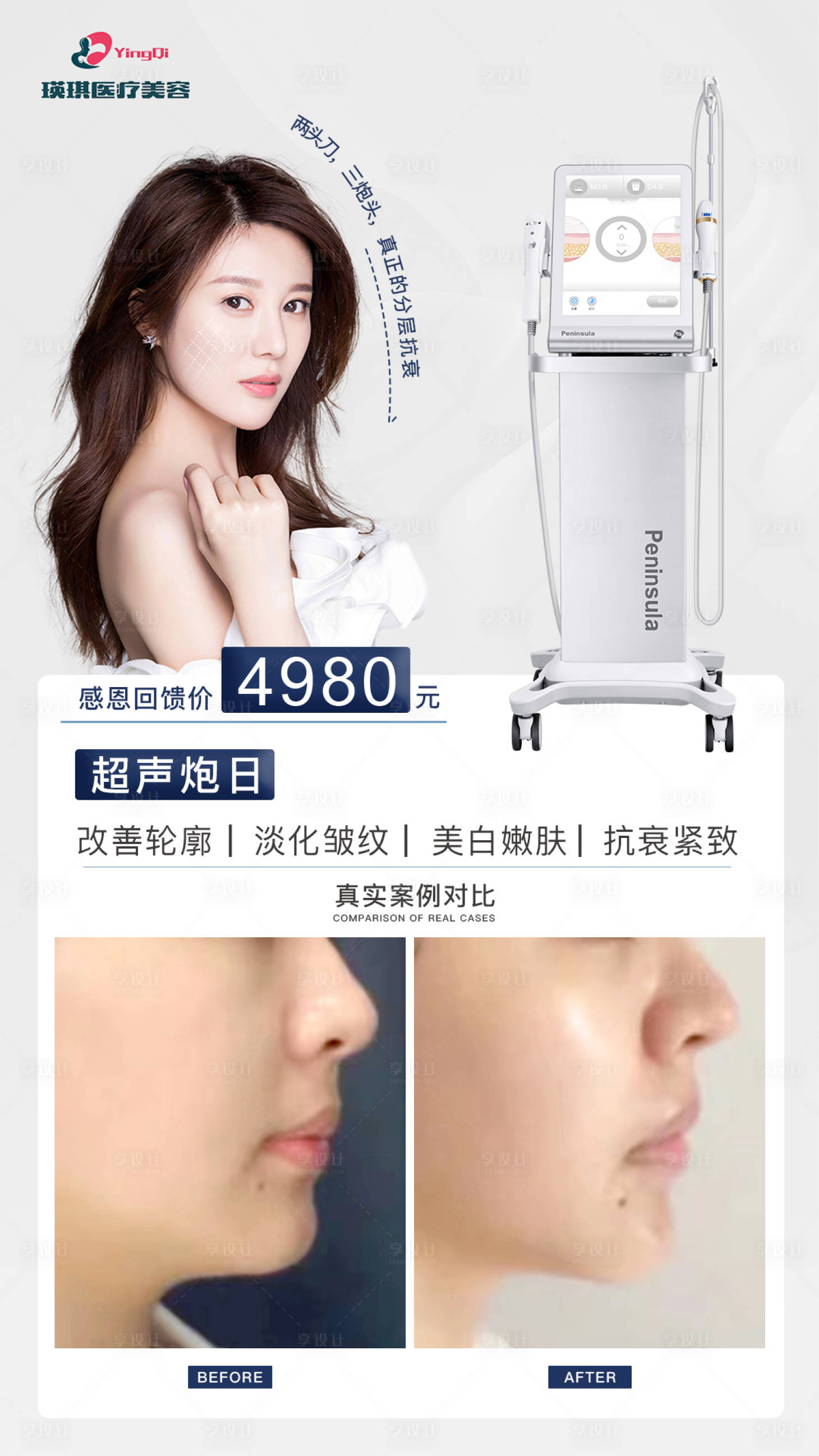 源文件下載【享設計】搜索編號：88490017201922742【醫美超聲炮海報】