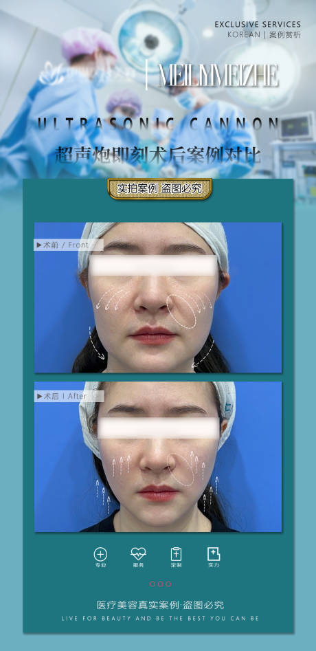 源文件下载【医美案例对比宣传海报】编号：39050017616906837