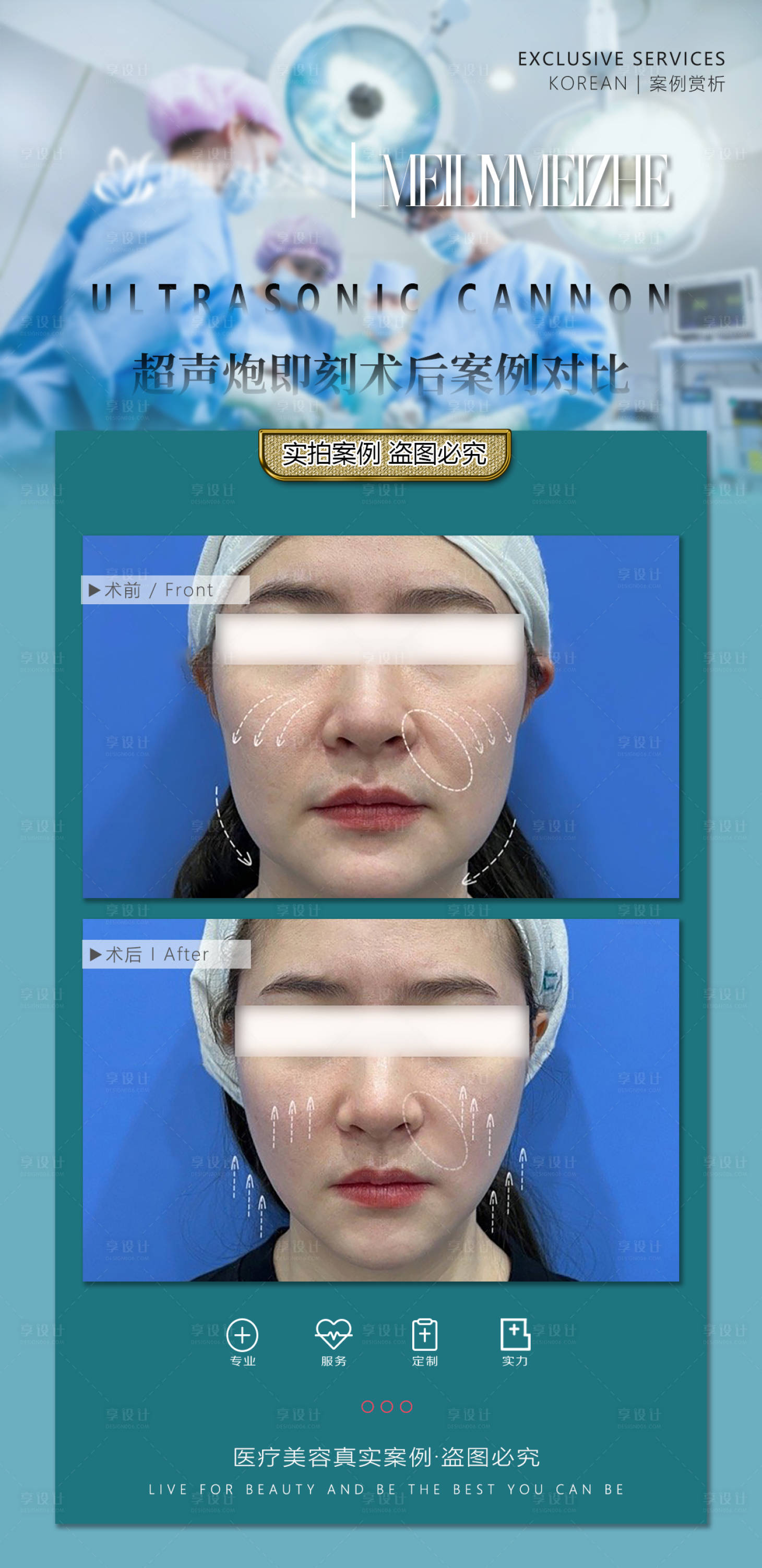 源文件下载【享设计】搜索编号：39050017616906837【医美案例对比宣传海报】
