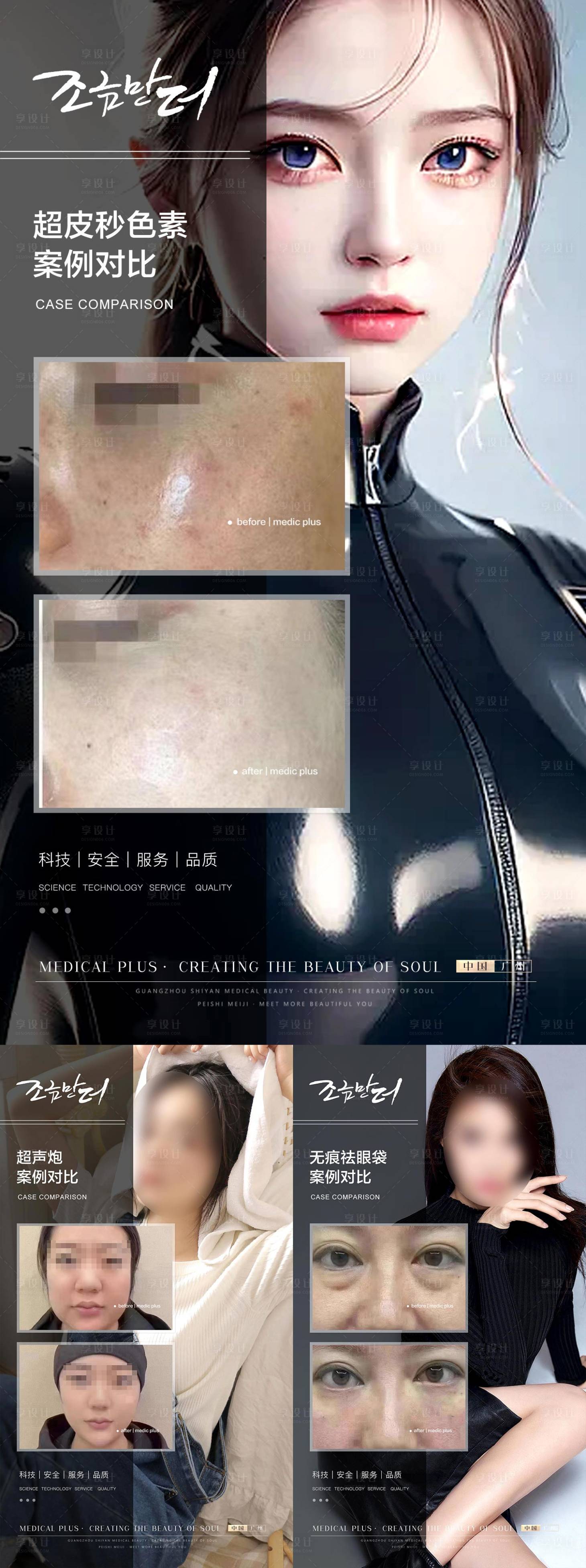 源文件下载【医美案例分享系列海报】编号：86490017616796147