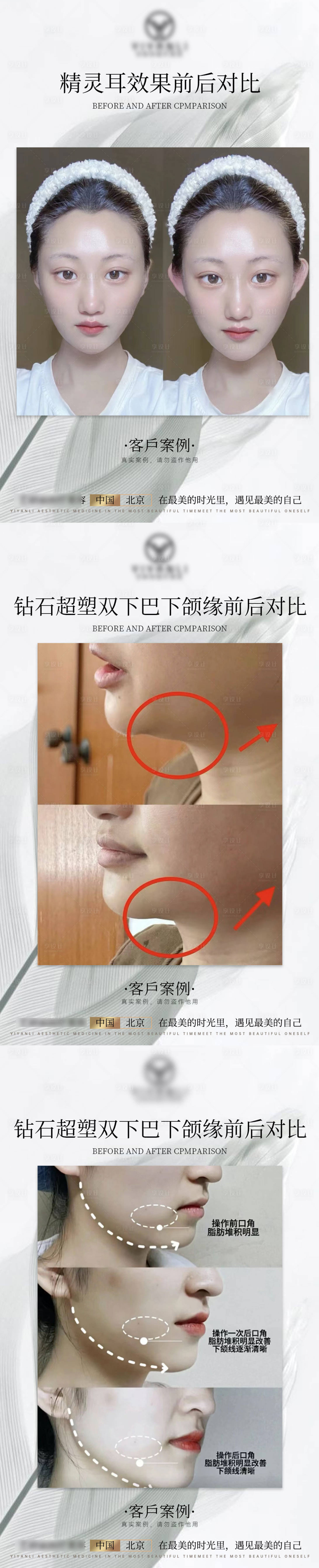 源文件下载【享设计】搜索编号：93910017575991324【对比图美业模板轻医美】