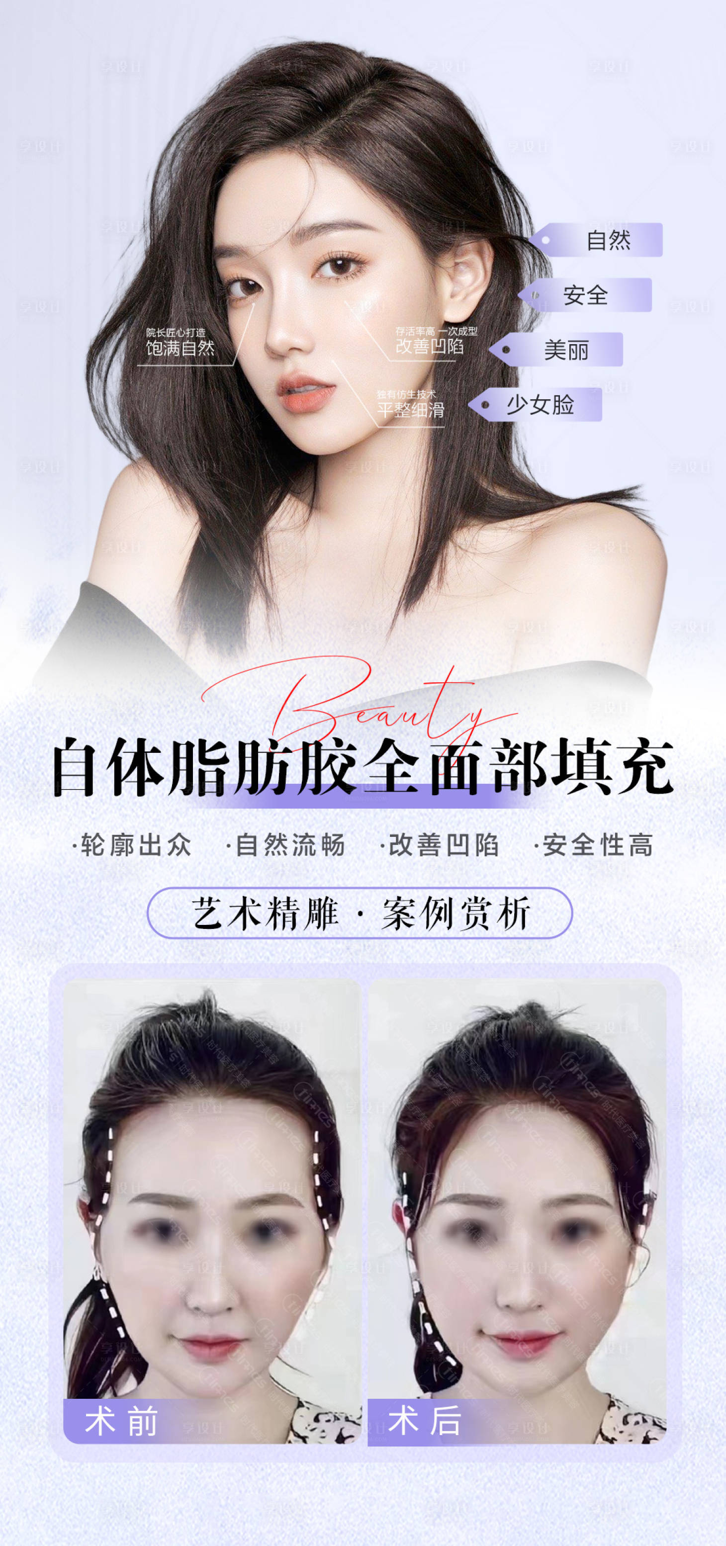 源文件下载【全面部自体脂肪填充海报】编号：67770017451427476