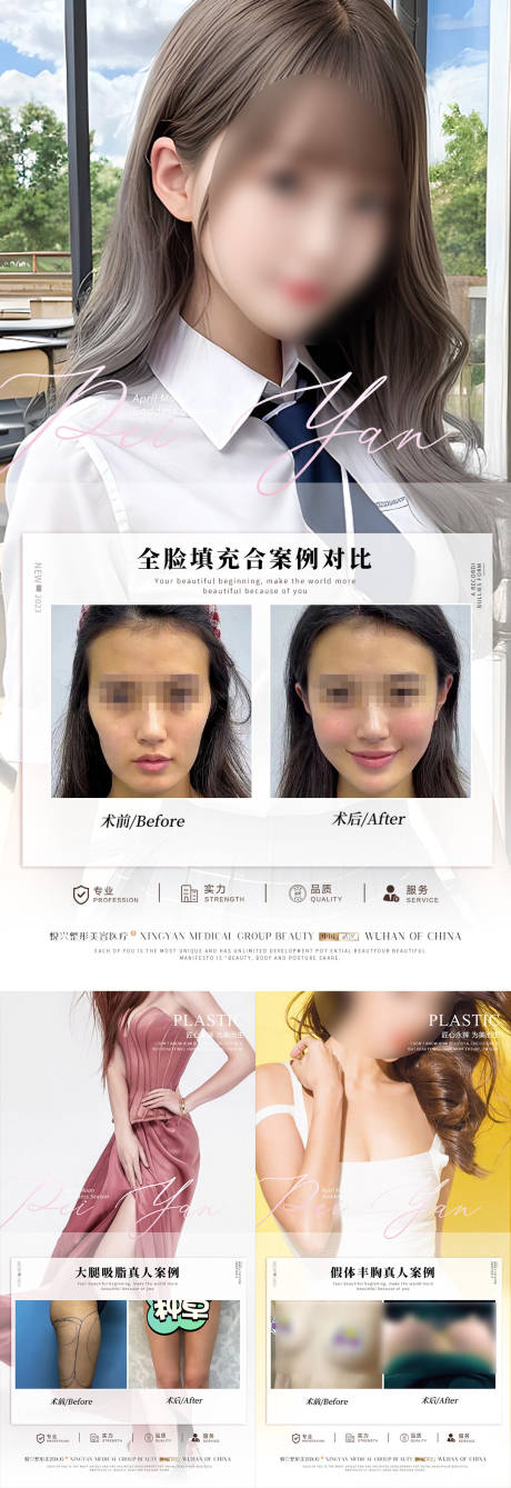 源文件下载【医美案例对比系列海报】编号：46170017569713896