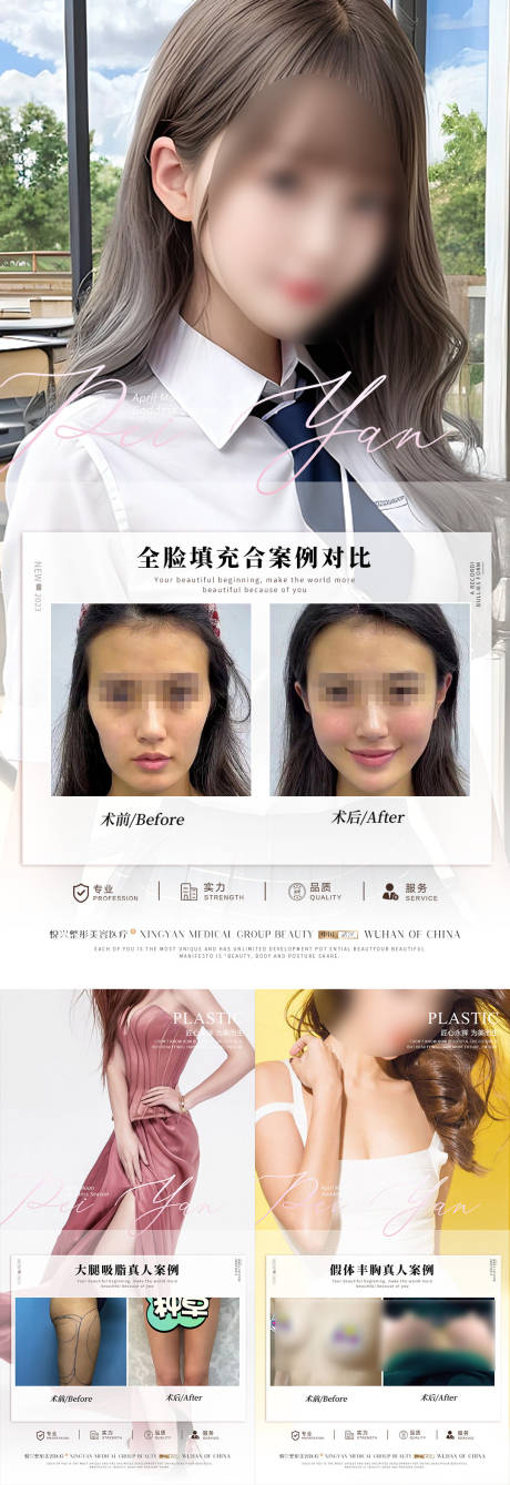 源文件下载【医美案例对比系列海报】编号：20230624104232883