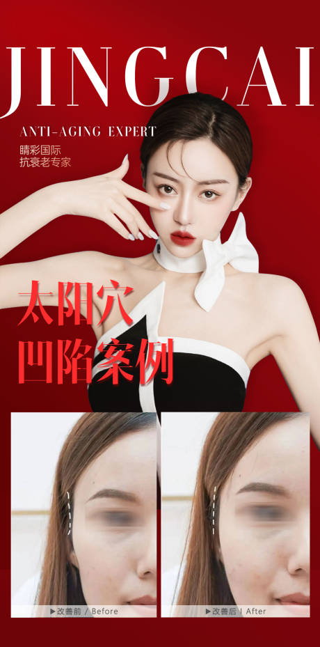 源文件下載【享設計】搜索編號：36300017575151216【太陽穴  】