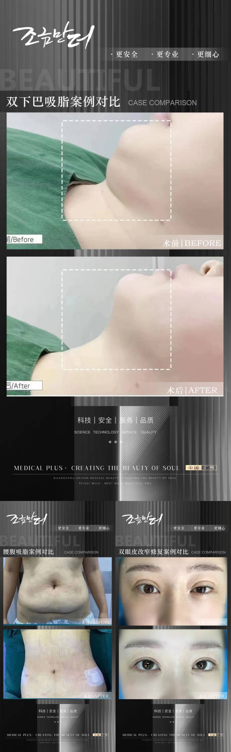 源文件下载【医美案例海报】编号：57740017549462560