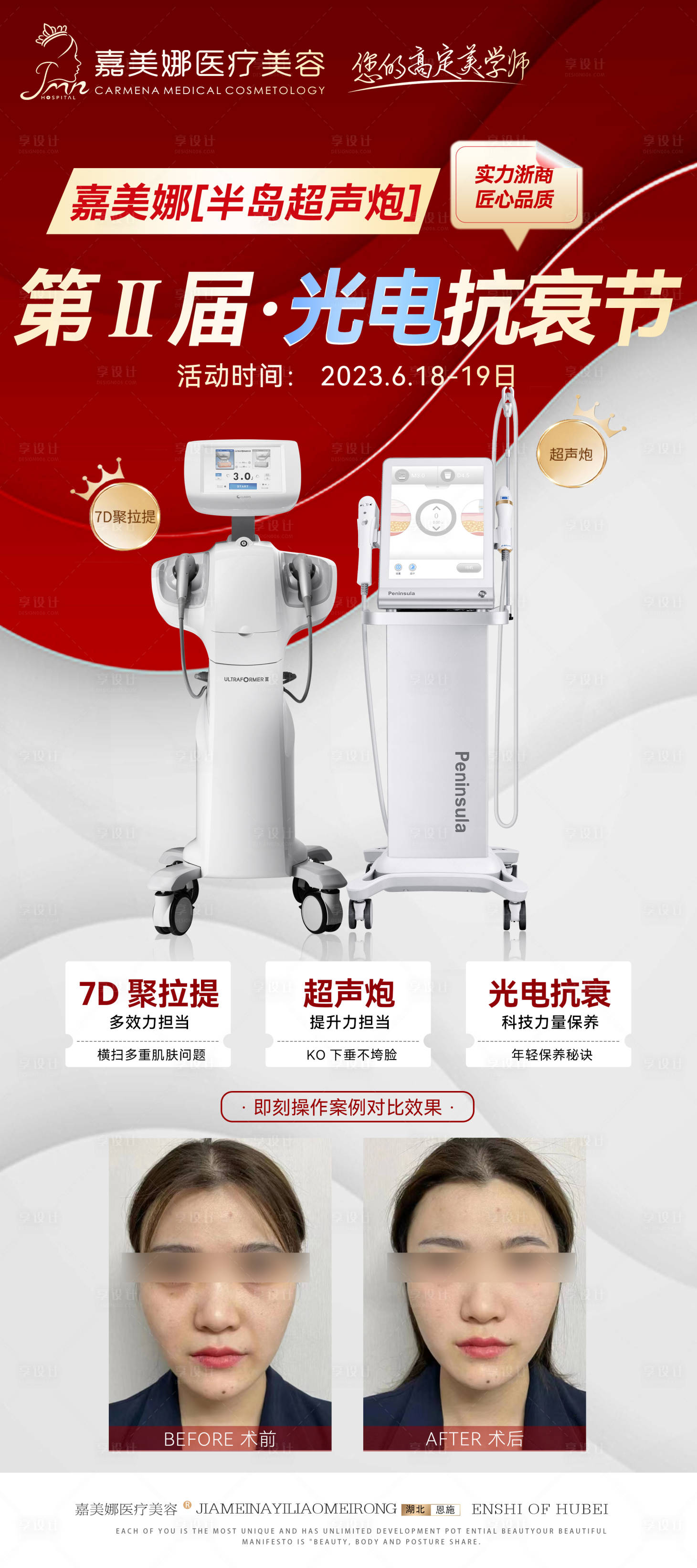 源文件下載【YU 超聲炮二代光電節】編號：74380017535986230