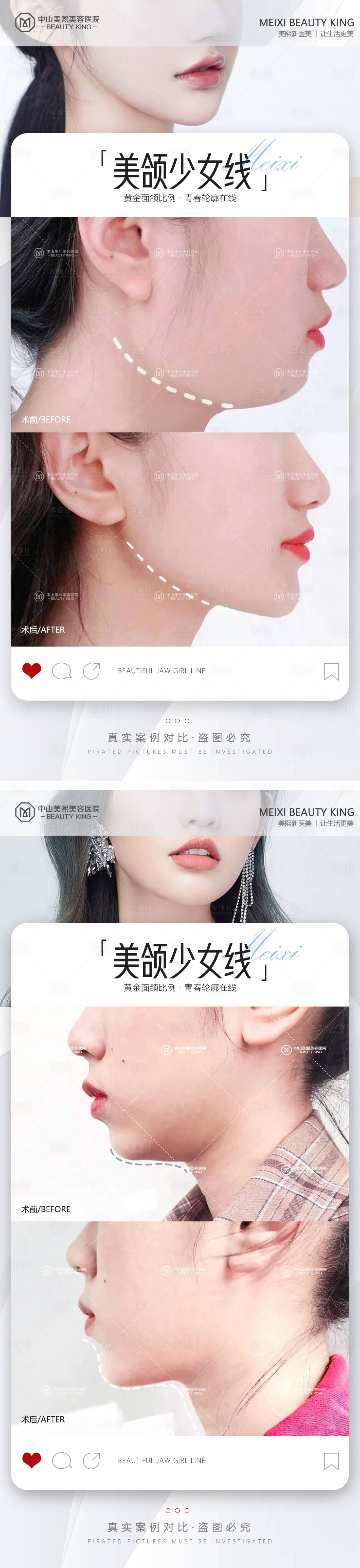 源文件下載【享設計】搜索編號：83600017656115544【下頜線案例海報】