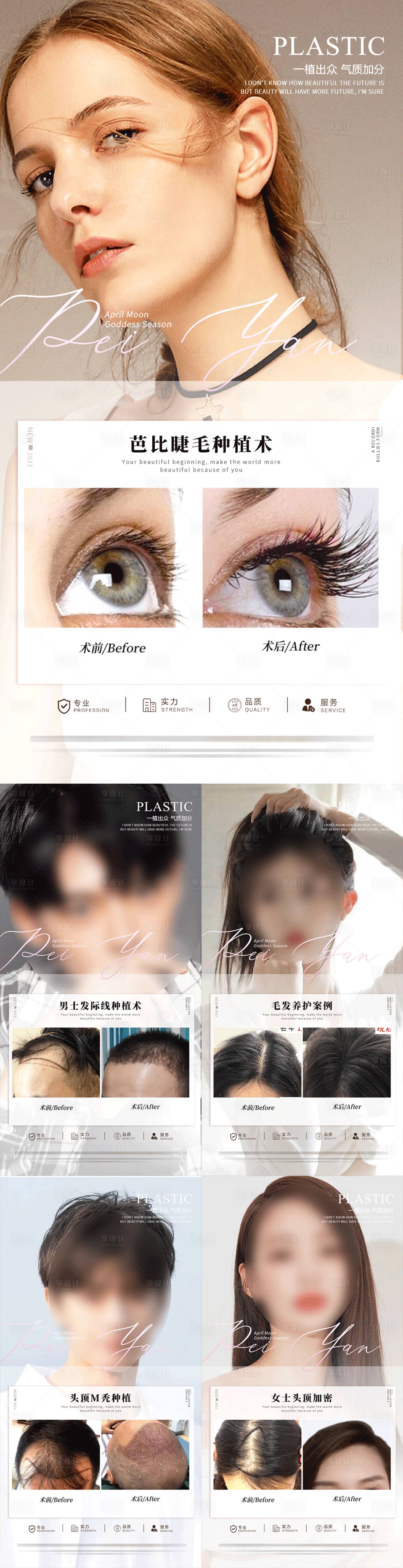 源文件下載【植發案例合集】編號：88040017731443383