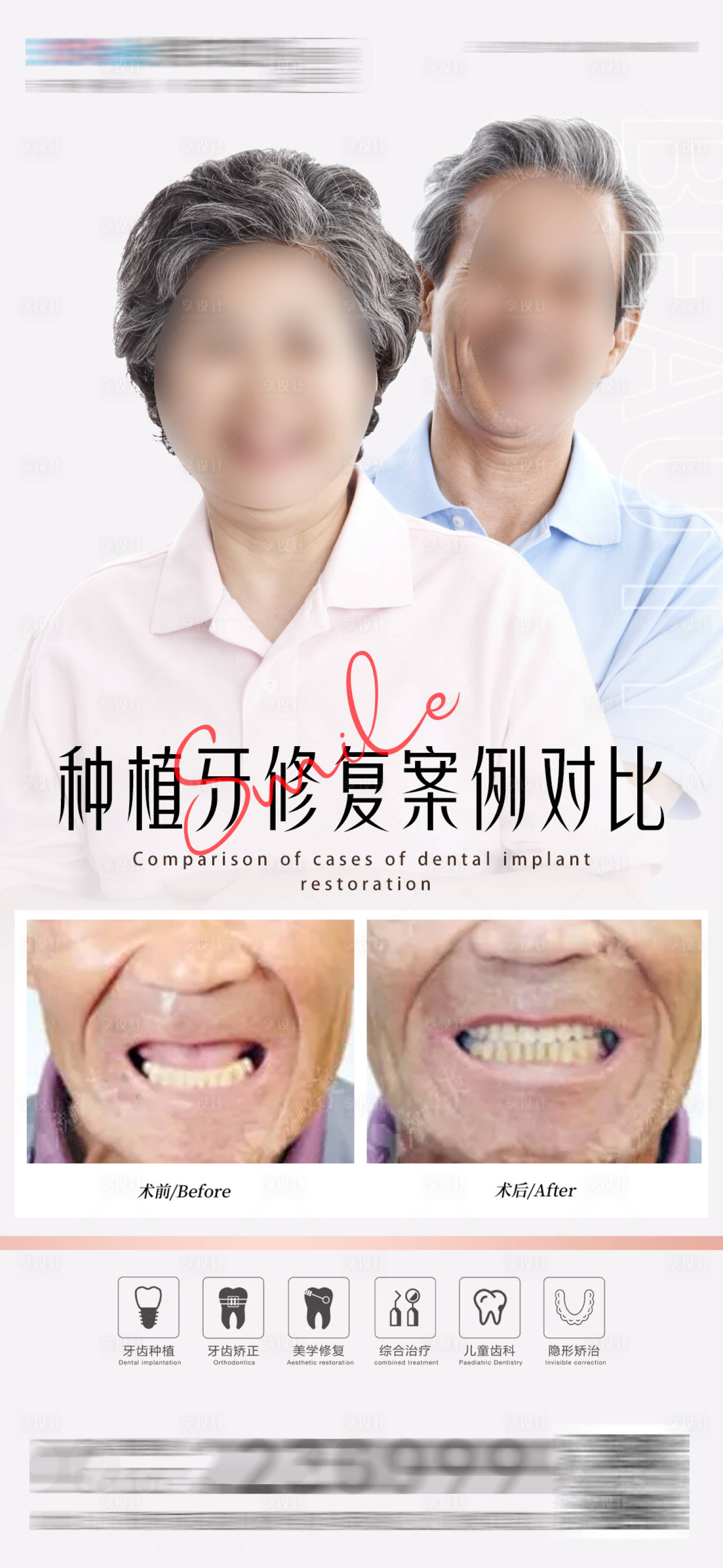 源文件下載【享設(shè)計】搜索編號：45240017197399314【醫(yī)美口腔種植牙對比海報】