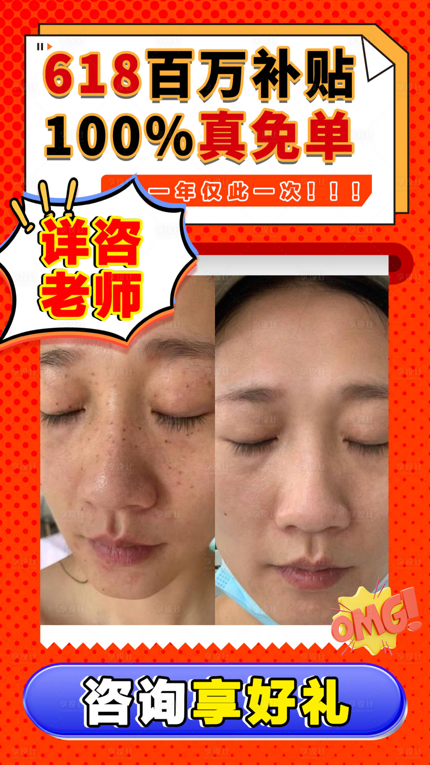 源文件下载【医美活动案例对比banner】编号：47850017412071706