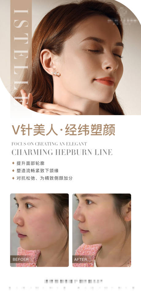 源文件下载【下颌缘提升医美案例对比海报】编号：69970017298151344