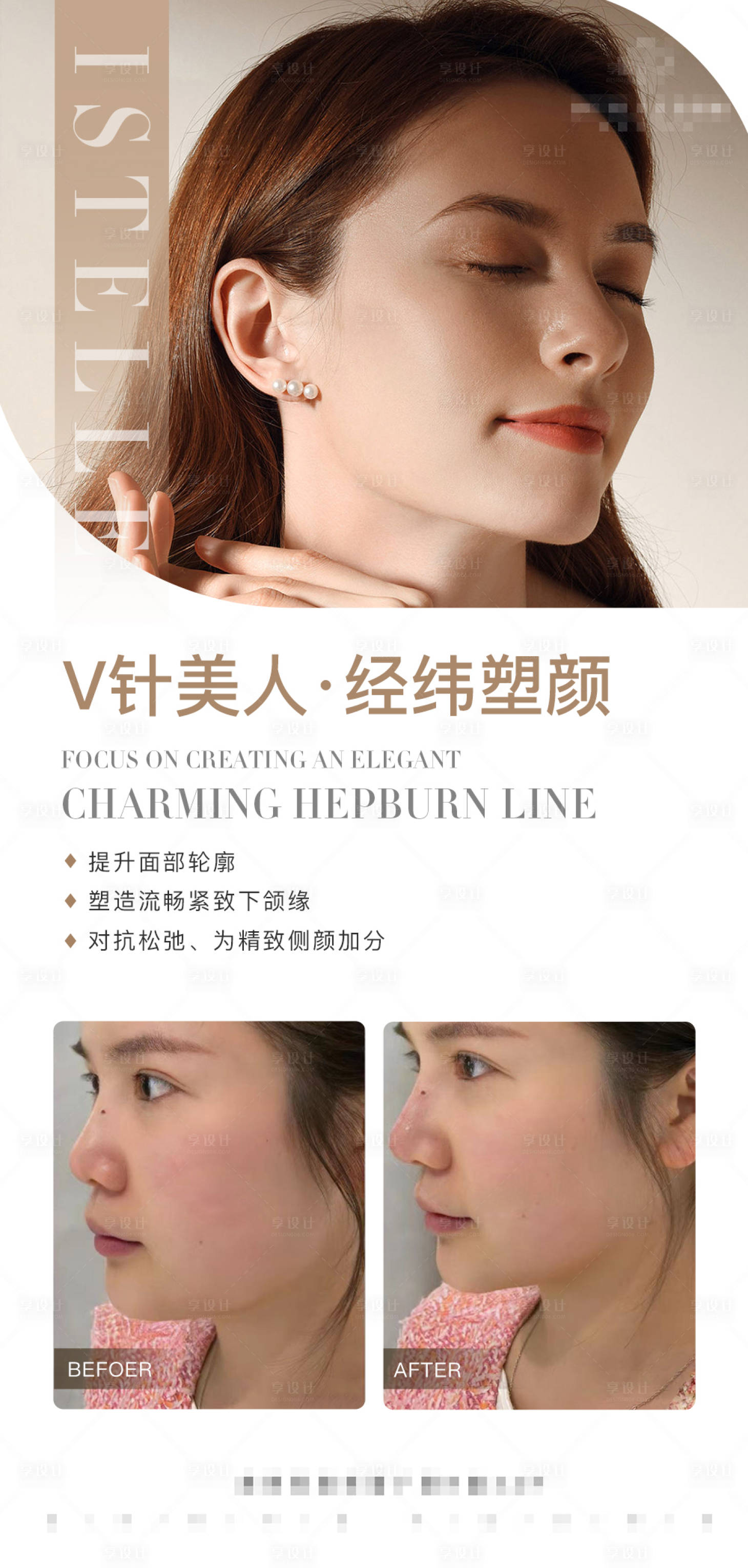 源文件下载【下颌缘提升医美案例对比海报】编号：69970017298151344