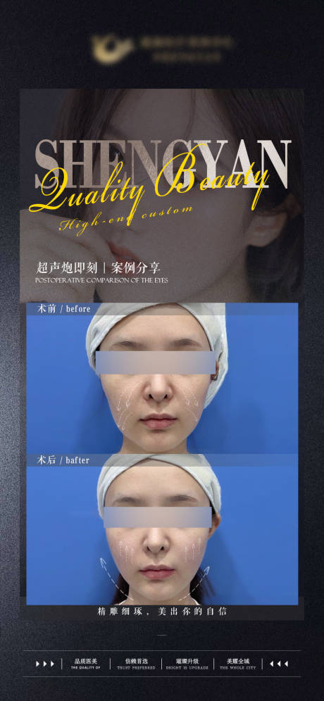 源文件下载【超声炮术前术后对比案例海报可更换】编号：44910017416449421