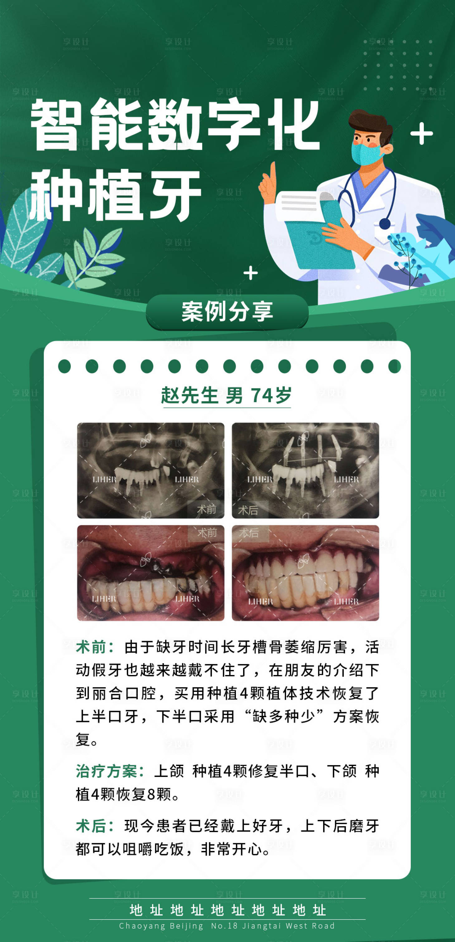 源文件下載【享設(shè)計(jì)】搜索編號：34150017539807028【種植牙案例】