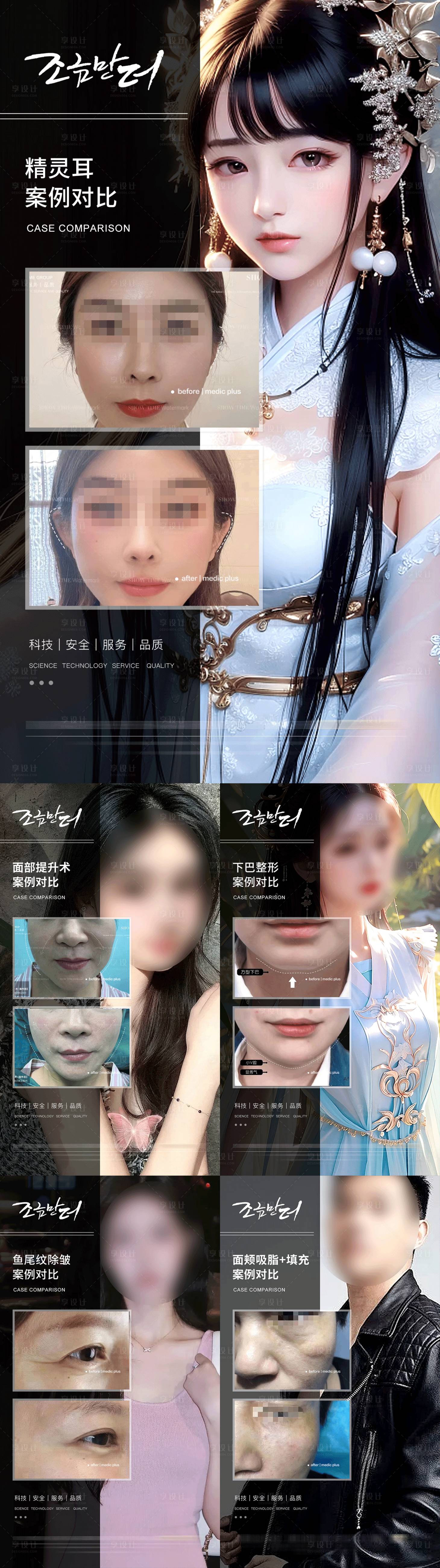 源文件下載【享設(shè)計】搜索編號：28330017690294475【整形真人案例分享集】