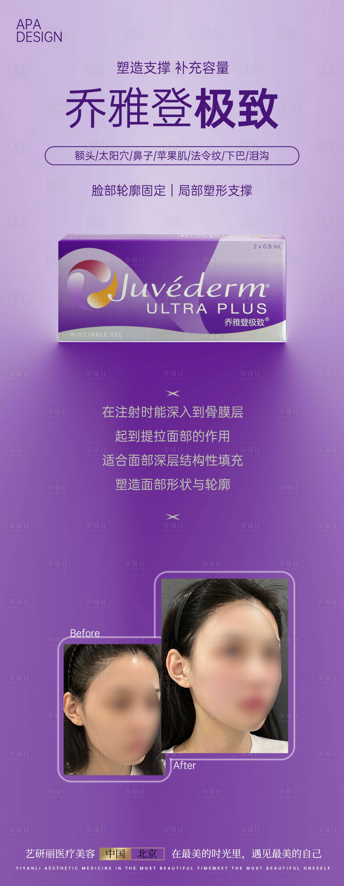 源文件下载【享设计】搜索编号：58090017627374253【轻医美乔雅登介绍对比海报】