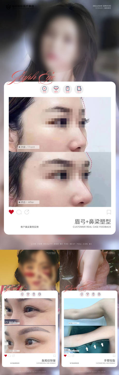 源文件下载【医美案例分享集】编号：88990017418885679