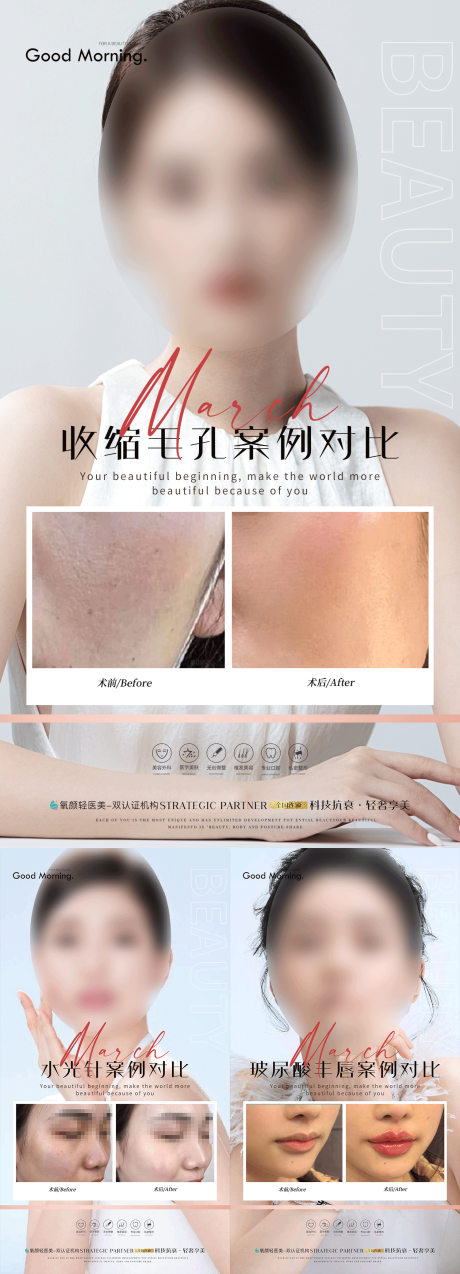 源文件下载【医美案例系列海报】编号：68200017281526753