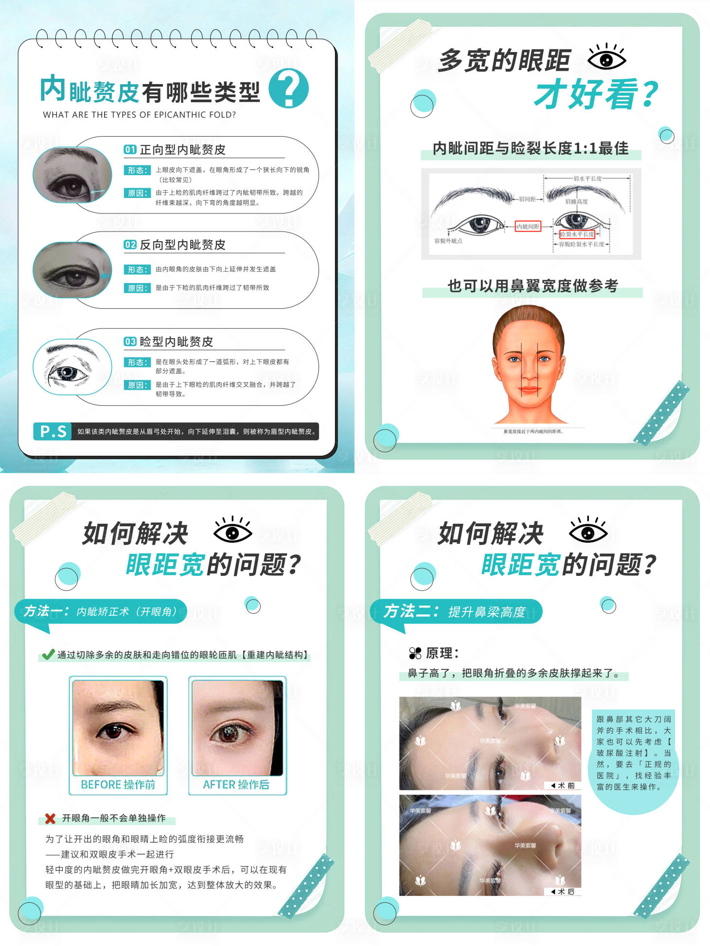 源文件下载【眼距科普海报】编号：24980017610925333