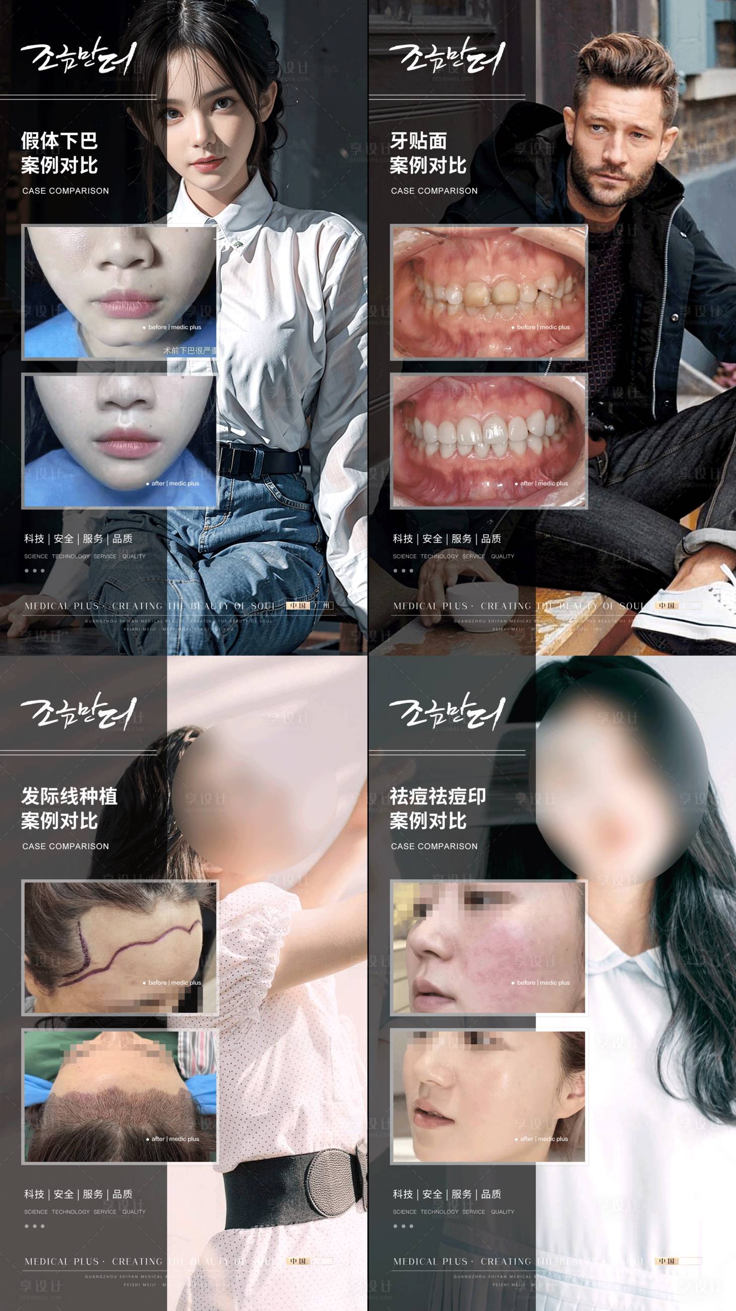 源文件下載【享設計】搜索編號：46950017717645018【醫美案例海報】