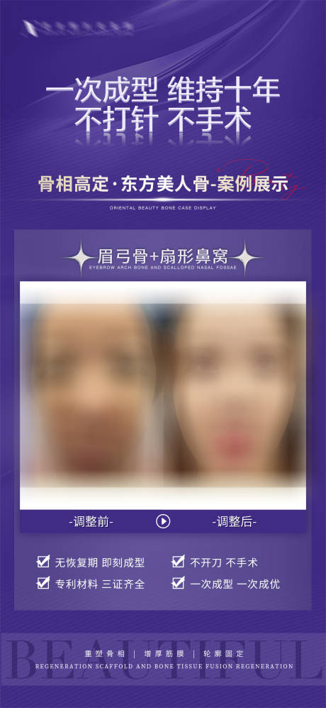 源文件下载【医美案例海报】编号：12340017210416834